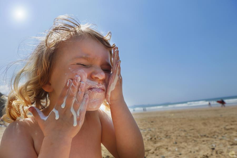 Drie op de vier kinderen liepen vorig jaar (pijnlijke) zonnebrand op
