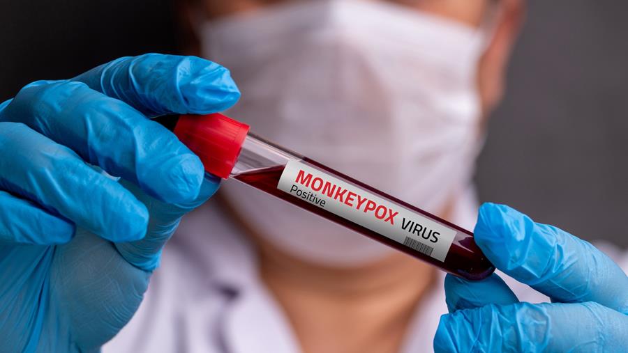 Un nouveau variant du mpox découvert en Angleterre